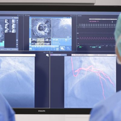 Philips Azurion R3 (Hospiten)